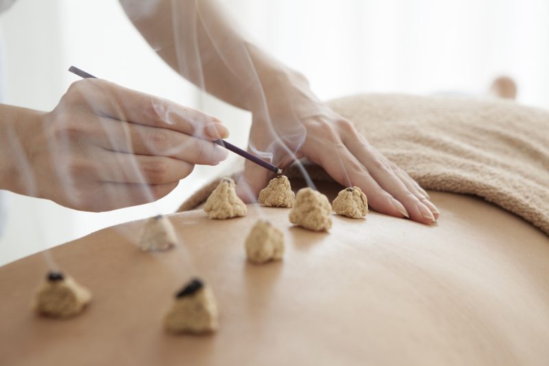 moxibustion